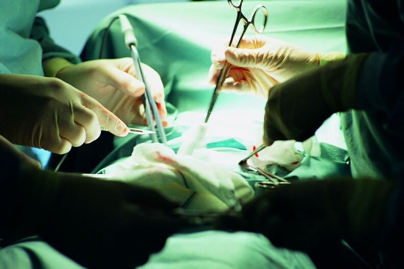 surgical increase in the thickness of the penis